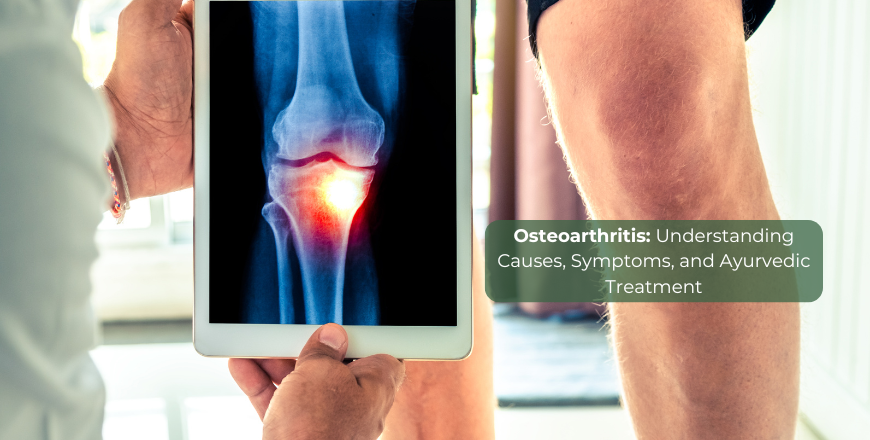 Osteoarthritis : Understanding Causes, Symptoms, and Ayurvedic Treatment